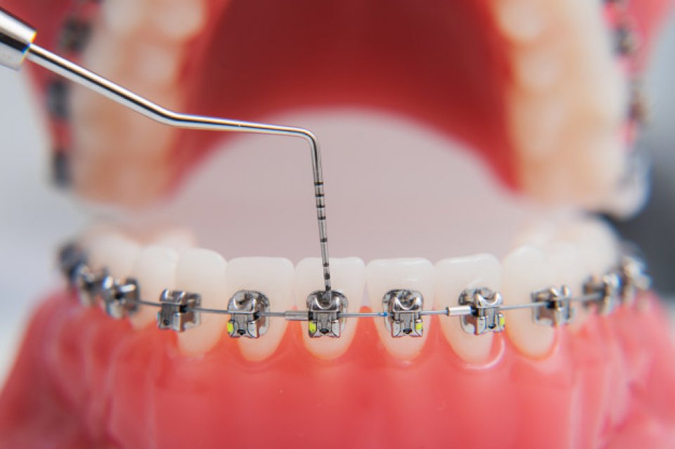 Profesjonalna asystentka ortodontyczna (warsztaty: część II)