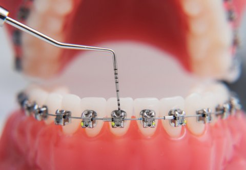 Profesjonalna asystentka ortodontyczna (warsztaty: część II)