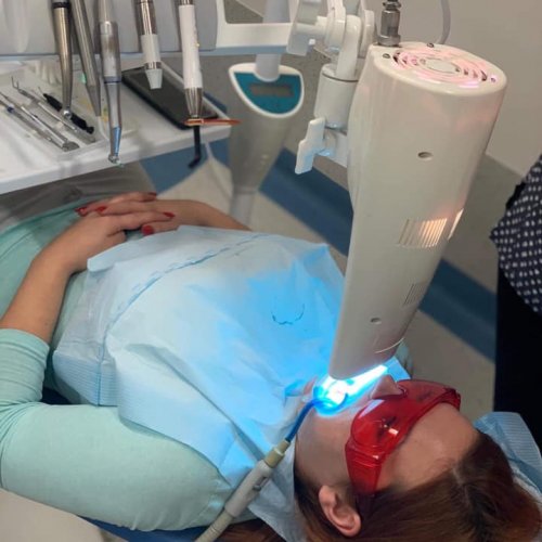 KURS - ''Stomatologia estetyczna - nowoczesne systemy wybielania zębów procedura-zabiegu - warsztaty''